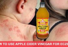 Use Apple Cider Vinegar To Treat Eczema